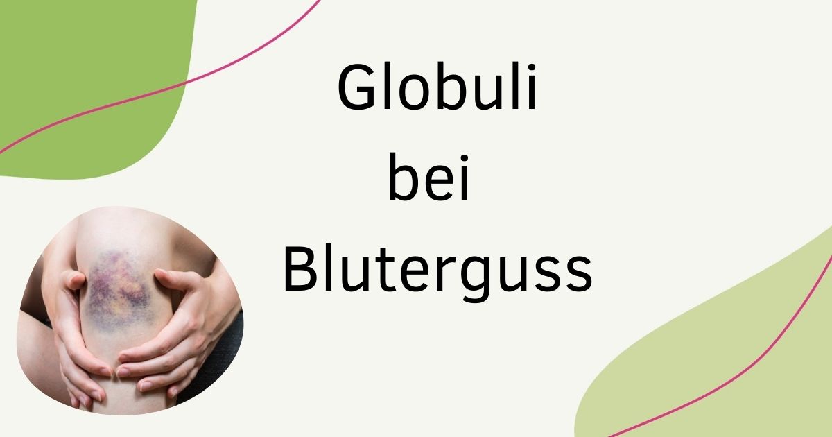 Wie Gehen Blutergüsse Schnell Weg natuerlich-einfach.de